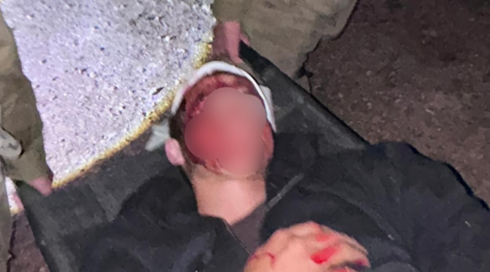 הפצוע היהודי בתקרית ליד תייסיר